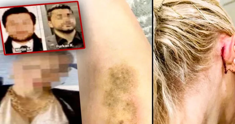Ünlülerin avukatına saldırı: Kulağı yırtıldı saçlarından sürüklendi!
