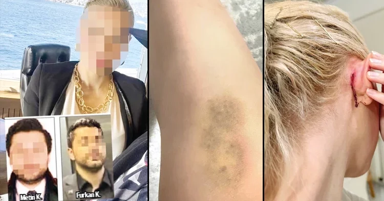 Ünlülerin avukatına saldırdılar