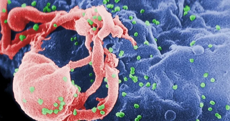 Piyangoyu iki kere kazandım dedi: Bir hasta daha HIV tedavisi olup kurtuldu