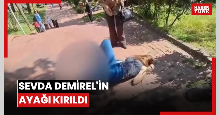 Sevda Demirel in ayağı kırıldı