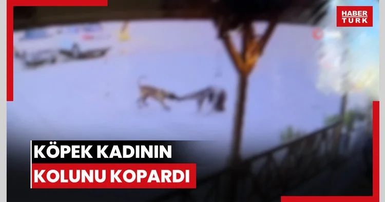 Köpek kadının kolunu kopardı