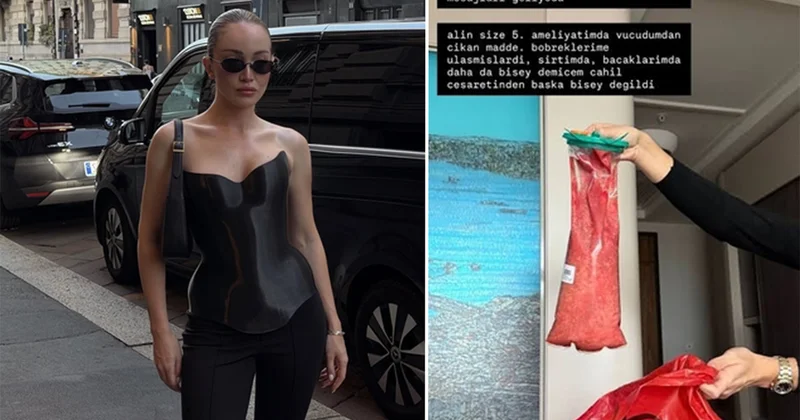 Danla Bilic yeniden ameliyat oldu! Sağlık durumuyla ilgili açıklama geldi