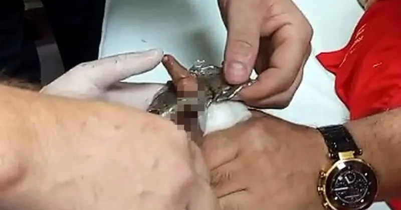 Bitlis’te parmağı çelik halkaya sıkışan çocuk itfaiye ekiplerince kurtarıldı