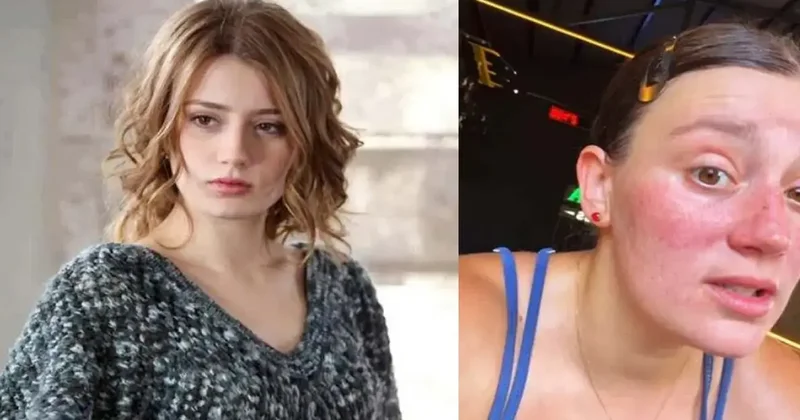 Gizem Karaca dan kilo isyanı: Neden kolay kilo alıyoruz?