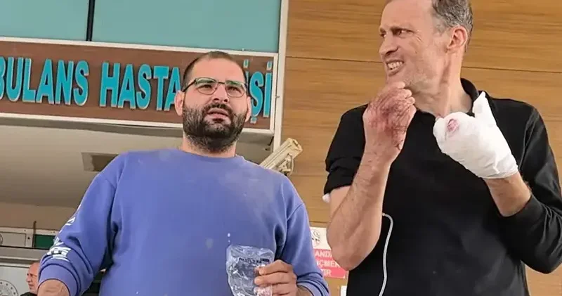 Elini makineye kaptıran atölye sahibinin 2 parmağı koptu