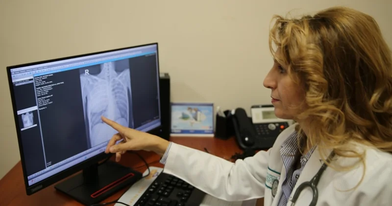 Akciğer kanserinde erken teşhis uyarısı! Sağlık Haberleri