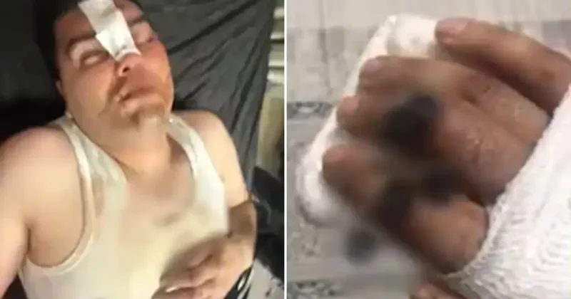 Hesabı ortak ödediler, dayağı tek başına yedi! Her şey 13 binlik çerez ile başladı