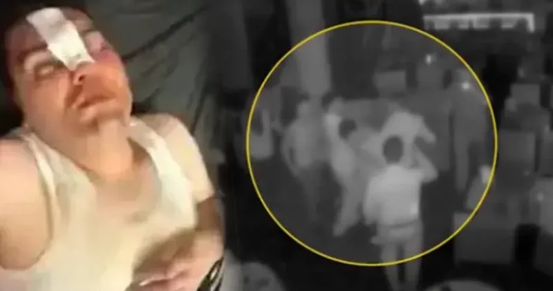 13 bin 500 liralık hesaba itiraz edince darbedildi: Çerezi arkadaşlarımla beraber, dayağı tek yedim!