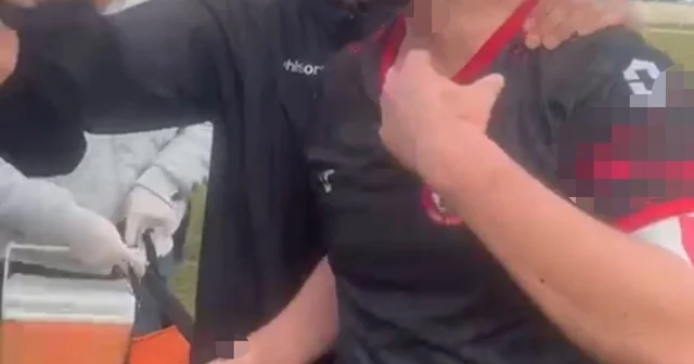 Maç sonu saha karıştı: 3 futbolcu yaralandı Yaralan futbolcu hastaneye kaldırıldı Bartın Haberleri