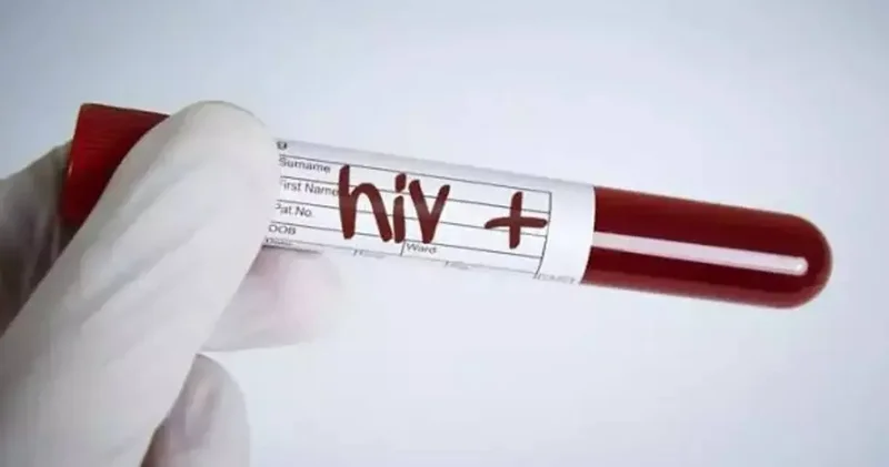 HIV vakalarında patlama yaşanmıştı! Altında yatan gerçek herkesi dehşete düşürdü