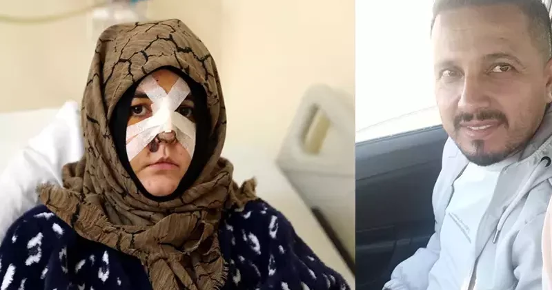 Boşanma aşamasındaki eşine vurduğu kaldırım taşı silah sayıldı