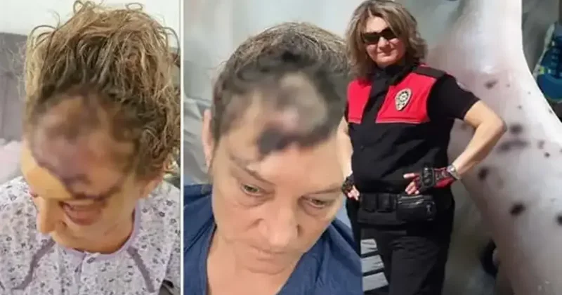 Vücuduna 80 dikiş atıldı: Patronunun köpeği tarafından parçalanan koruma isyan etti