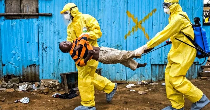 65 kişi şimdiden yaşamını yitirdi: Afrika da salgın hızla yayılıyor Sözcü Gazetesi