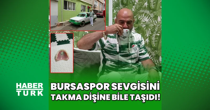 Bursaspor’un fanatik taraftarı takma dişinin damağına da kulüp amblemi yaptırdı!