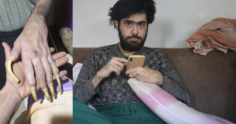 Akıllara durgunluk veren olay! Cep telefonu yüzünden 3 yıldır evden dışarı adım atmadı