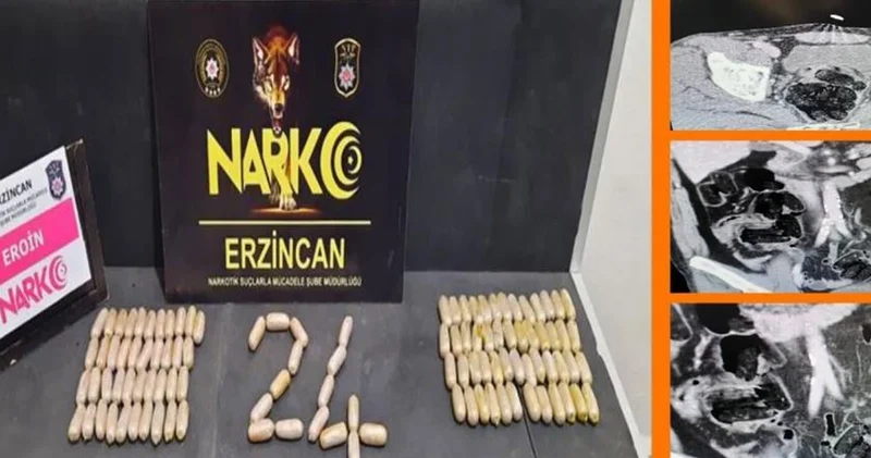 Erzincan da narkotik operasyonu: Midelerinden çıkanlar şoke etti