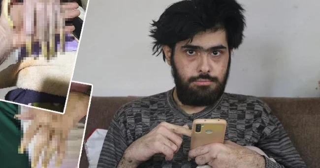 3 yıldır evden dışarı çıkmıyor! Depremden sonra bu hale geldi Sadece telefonla oynuyor: Elimde olsa tuvalete de gitmem yemek de yemem