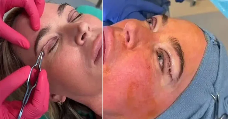 4. evre kanser tedavisi görürken estetik yaptırdı: Doktorlarım onay verdi
