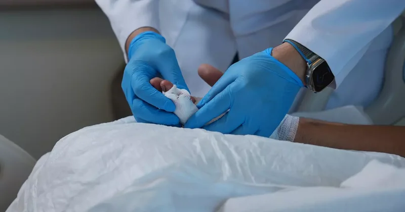 Dakikalarla yarışılan operasyon: Kopan parmak mikrocerrahi yöntemiyle dikildi