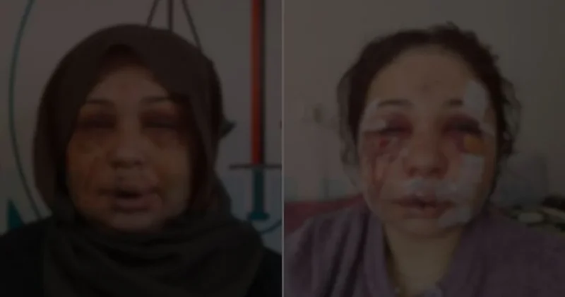 Eşini hastanelik eden polis, ifade verip serbest kaldı Sözcü Gazetesi