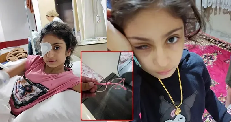 Şeyma ‘plastik’ sanılan gözlük camı kırılıp gözüne batınca sağ gözünü kaybetti; aile şikayetçi oldu