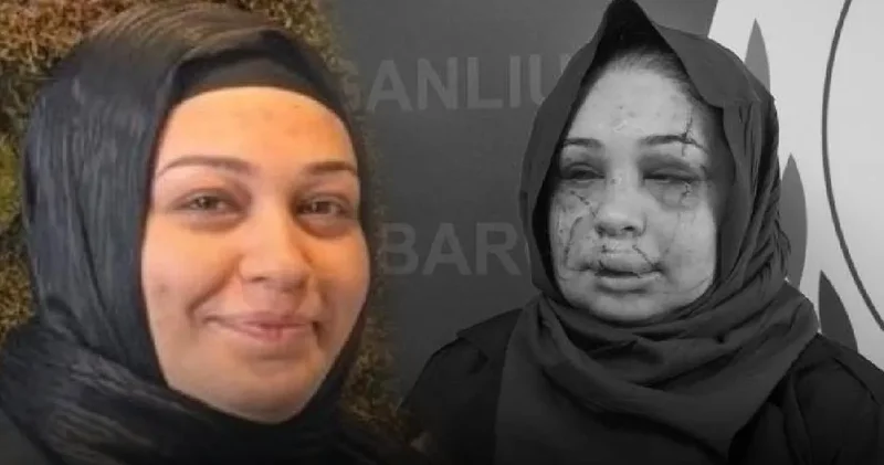 Boşanmak isteyen eşini bayıltıp yüzünü parçaladı! Polis koca serbest