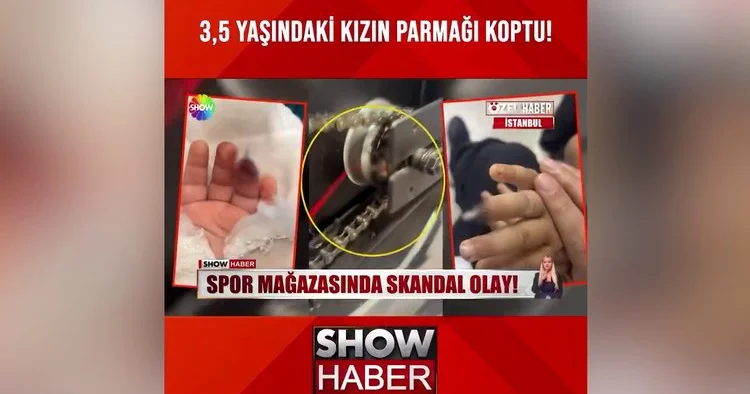Bisiklet, parmağını kopardı!