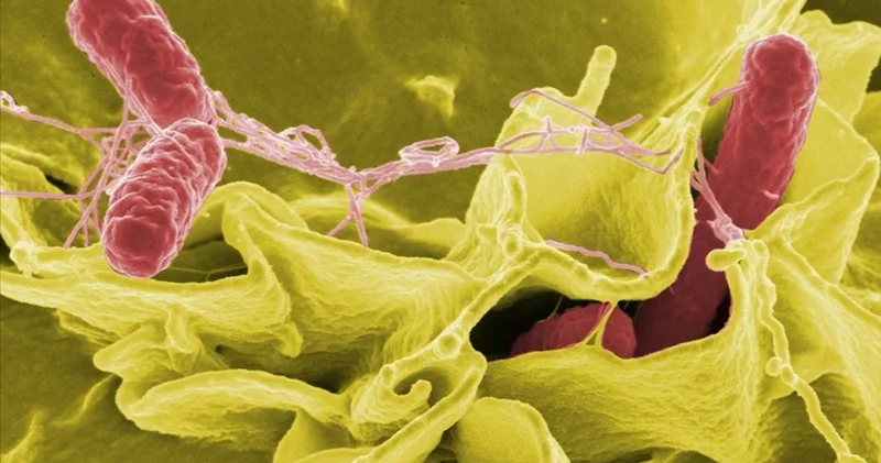 Uzmandan salmonella uyarısı: Sadece mideyi değil, organları da vuruyor