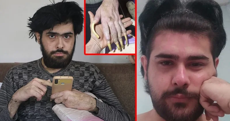 SON DAKİKA: 3 yıldır evden çıkmayan telefon bağımlısı genç çok konuşulmuştu! Arkadaşları anlattı: O güne kadar çok bakımlıydı...