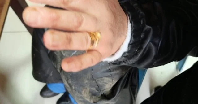 Diyarbakır da başıboş sokak köpeği dehşeti Diyarbakır Haberleri