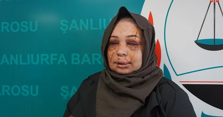 Ankara da kadına şiddete tutuklama! Bakan Tunç ve Göktaş tan açıklama