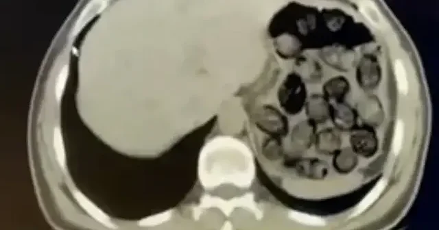 Diyarbakır da midelerinde uyuşturucu bulunan yabancı uyruklu 2 şüpheli tutuklandı VİDEO İZLE