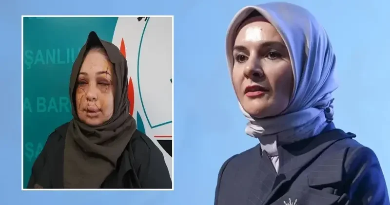 Bakan Göktaş tan Ankara da eşinden şiddet gören kadına ilişkin açıklama: Davaya müdahil olacağız Gündem Haberleri