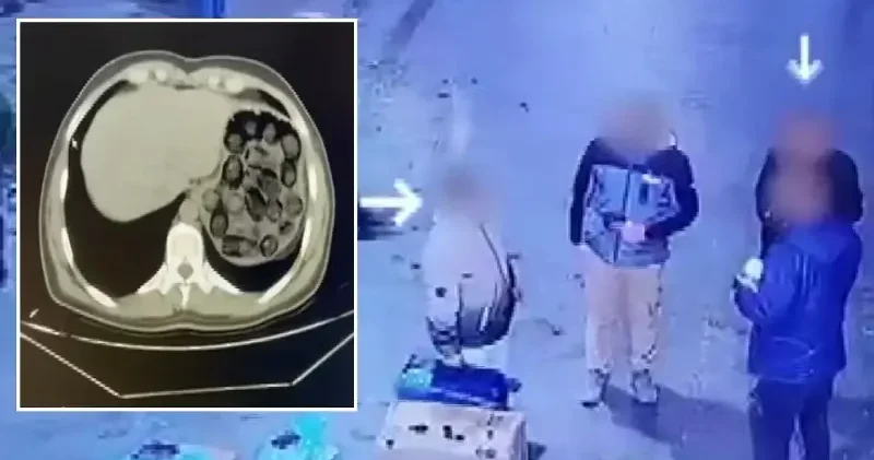 Mide ve bağırsaklarından 91 kapsül metamfetamin çıktı Gündem Haberleri