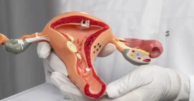 HPV aşısı serviks kanserinden koruyor