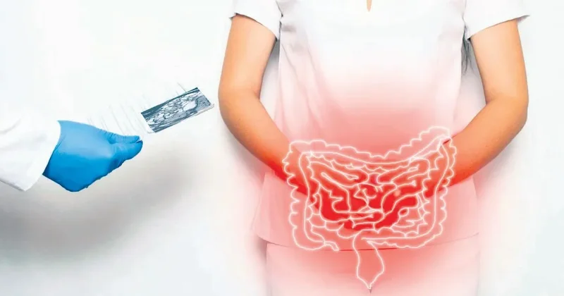 Bağırsaktaki gizli kahraman bulundu