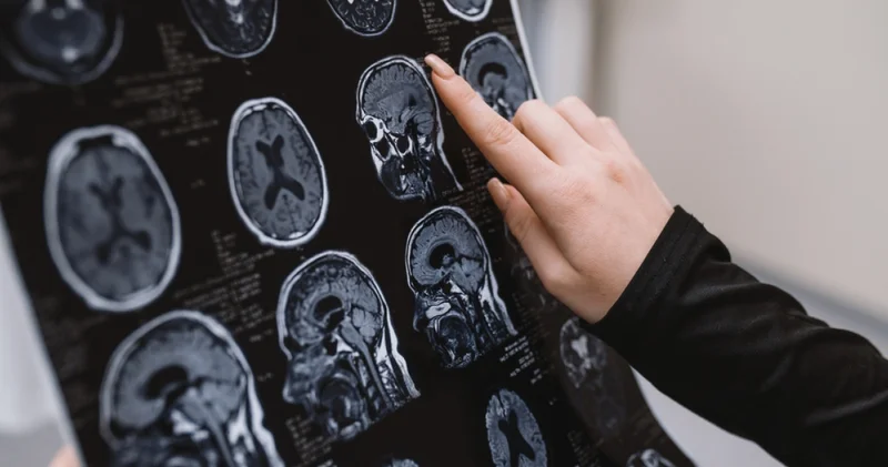 Alzheimer hastalarının üçte ikisini kadınlar oluşturuyor Haberler Sağlık Haberleri