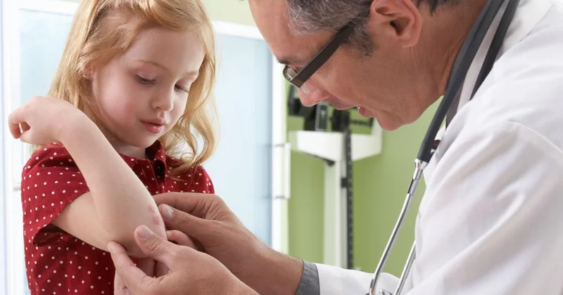 Uzmanından hemofili uyarısı: Çocuklardaki morluklar masum olmayabilir