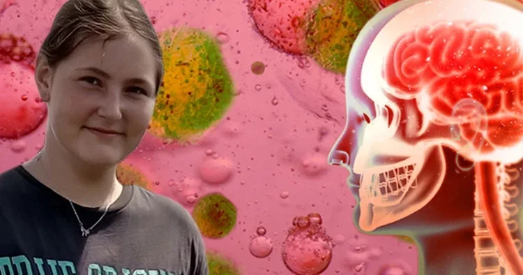 Panik dalgası büyüyor: 14 yaşındaki Çağla’yı hayattan kopardı... Türkiye’de vakalar artıyor mu? Bu ‘hayati işaretleri’ mutlaka öğrenin