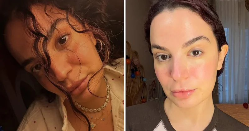 7 kez ameliyat oldu ama hastaneden yine çıkamadı Sözcü Gazetesi