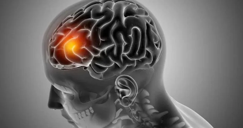 Yeni bir tedavi yolu başlıyor: Sinir onarımı artık mümkün mü?