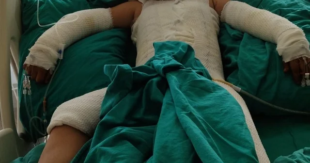 Trafoya takılan uçurtmasını almak isterken akıma kapılan çocuk ağır yaralandı; babadan ihmal iddiası Adana Haberleri