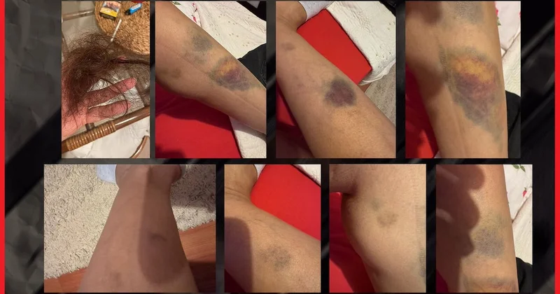 Karısını aldatıp sevgilisini dövmüştü! Sessiz sedasız AKP den istifa ettirildi Sözcü Gazetesi