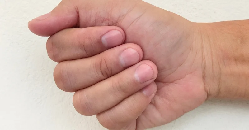Tırnakta renk değişimi ne anlama geliyor? Eğer bir anda değiştiyse dikkat edin Sözcü Gazetesi
