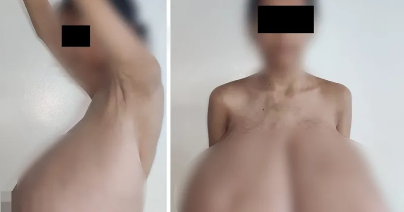 13 yaşında başladı! Göğüsleri vücut ağırlığının dörtte birine ulaştı