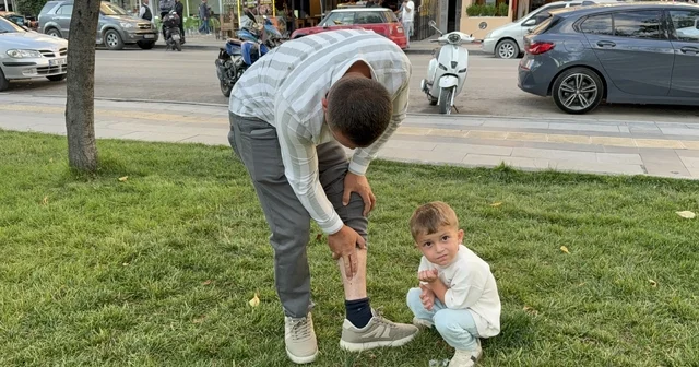Vücuduna tutunan kene ile yüzük takma merasimine katılan besici, tehlikeyi hiçe sayarak Keneyi besiye aldık dedi Tokat Haberleri Habertürk Yerel Haberler