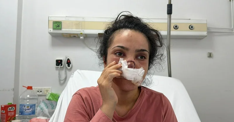 Manisa da Yamyam eski koca dehşeti! Burnu koparılan kadın o anları anlattı Sözcü Gazetesi