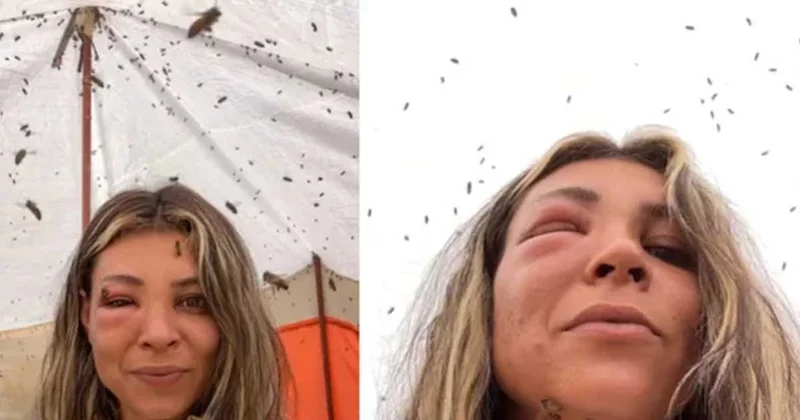 Arılarıyla yakın bağ kurmak istedi: Yüzü tanınmaz hale geldi Sözcü Gazetesi