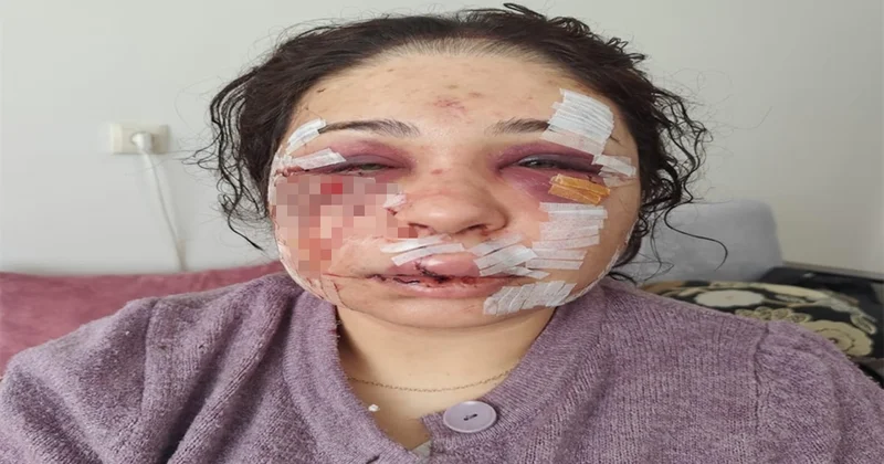 Boşanma sürecindeki eşini darbeden polis memuru tahliye edildi Sözcü Gazetesi