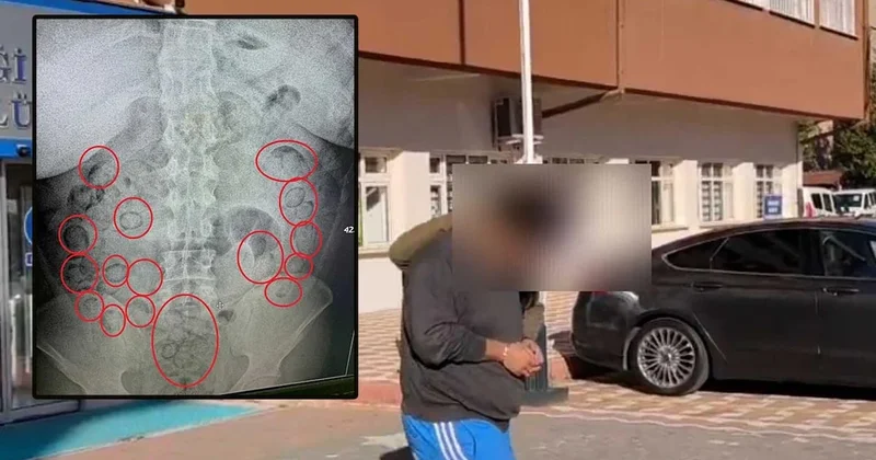 Skandal röntgende ortaya çıktı! 400 gram uyuşturucu bakın neresinden çıktı Sözcü Gazetesi